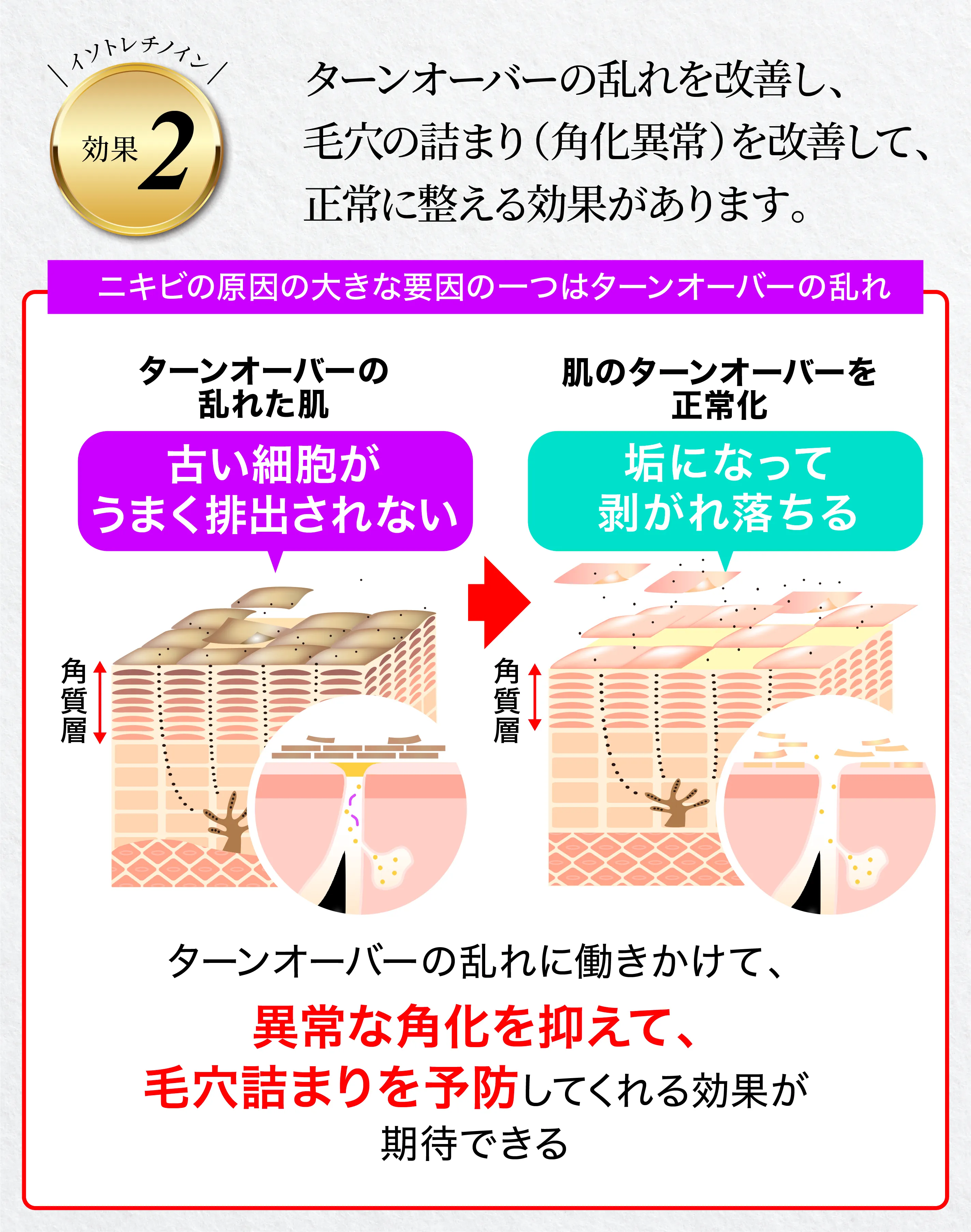 イソトレチノインの効果②ターンオーバーの促進