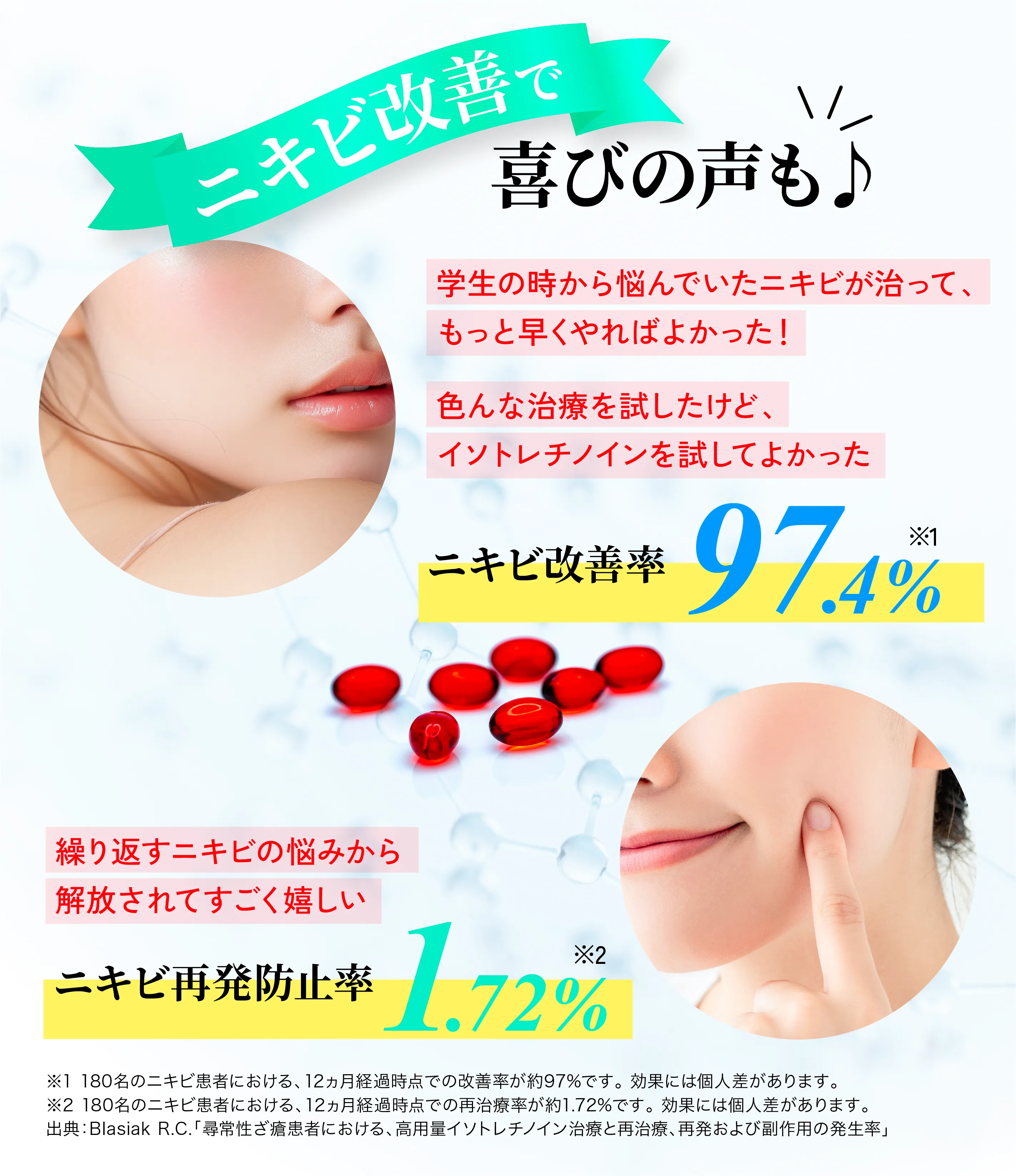イソトレチノインの体験での喜びの声